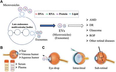 Extracellular vesicles: an emerging player in retinal homeostasis